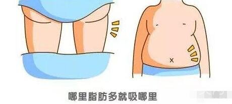 自體脂肪填充術(shù)前檢查及術(shù)后護(hù)理事項(xiàng)