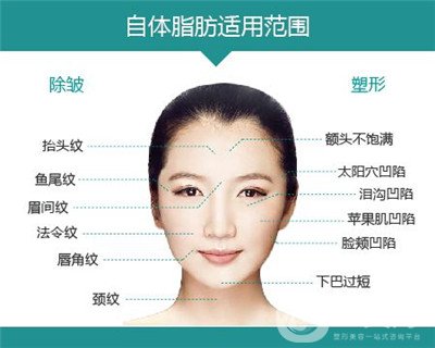 北京自體脂肪填充醫(yī)院有哪些？好的有哪些？