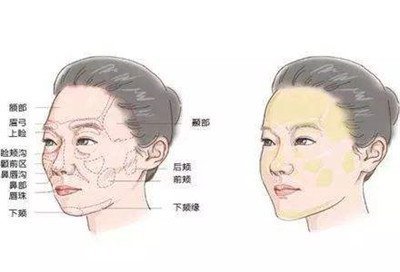 北京自體脂肪填充醫(yī)院有哪些？好的有哪些？
