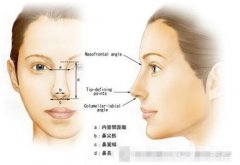 鼻小柱延長(zhǎng)恢復(fù)過程及護(hù)理要點(diǎn)總結(jié)