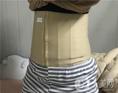 腰腹環(huán)吸后要腫多長(zhǎng)時(shí)間呢？可以活動(dòng)嗎？