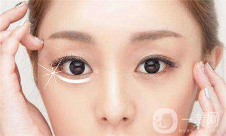 眼部提升手術(shù)怎么做？多久恢復(fù)？