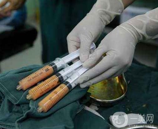 腰部吸脂的費用大概多少錢？術(shù)后真的能瘦嗎？