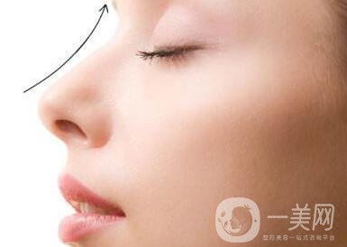 北京整容墊鼻梁多少錢？附隆鼻價(jià)格明細(xì)一覽表