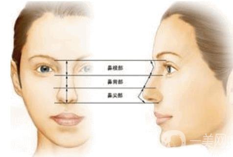 北京朝天鼻整容多少錢?具體怎么改良？