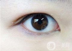 內(nèi)雙怎么變外雙？能貼雙眼皮貼嗎？