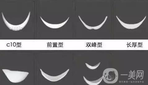 膨體隆下巴多久會變軟？容易取出來嗎？
