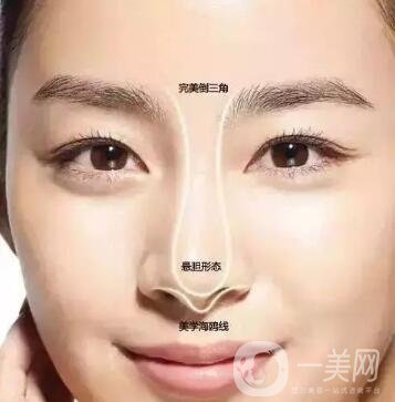 隆鼻手術(shù)怎么做？操作過(guò)程解析