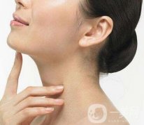 減下巴方法有哪些？可以吸脂嗎？