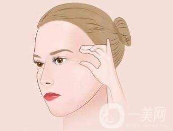 小切口除皺術(shù)后恢復(fù)過程是怎樣的？