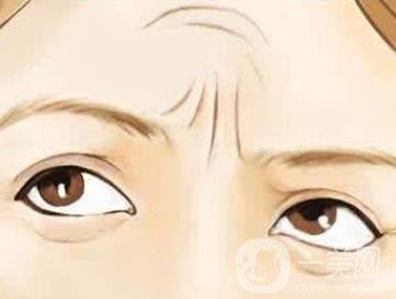 抬頭紋怎么去除？價格是多少呢？