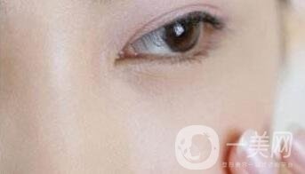 玻尿酸豐淚溝有危險嗎？能管多久？