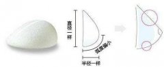 水滴型假體隆胸優(yōu)勢(shì)在哪里?需要多少錢?