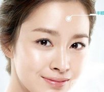 隆額頭材料哪種比較好？要多少錢？