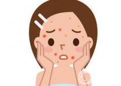 激光治痘疤需要做幾次?多久見?