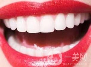 鑲牙的種類各有什么優(yōu)缺點