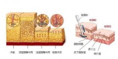 360度吸脂的手術需要多少錢？