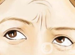 抬頭紋手術(shù)價(jià)格貴嗎?大概要多少錢?