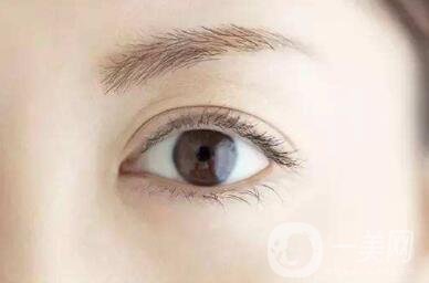 開眼角好嗎？*果怎么樣？
