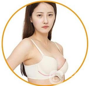 娜綺麗假體隆胸后多久可以變軟？