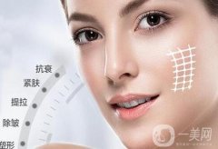 大拉皮除皺恢復(fù)時間要多久?可以做第二次嗎?