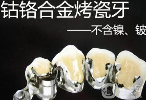 烤瓷牙價(jià)格和種類(lèi)詳解公布
