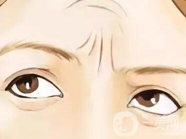 提升除皺手術多少錢?價格會有變化嗎