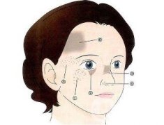 祛斑手術(shù)價格貴不貴？要多少錢？