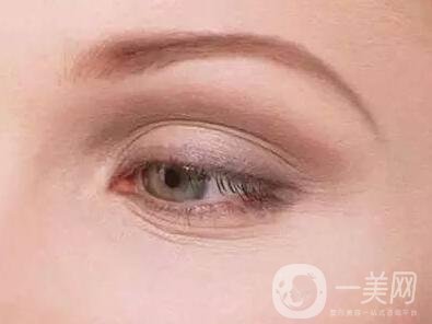 去除魚尾紋的方法有哪些？哪種方法比較好？