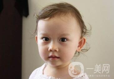 去頰脂墊價格貴嗎？大概價位是多少？