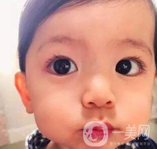 去頰脂墊價格貴嗎？大概價位是多少？