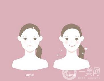 去頰脂墊有副作用嗎？術(shù)后如何護(hù)理可以減小副作用？