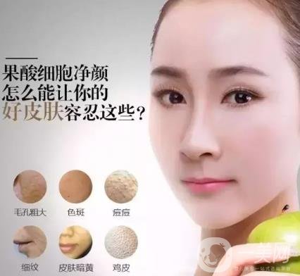 果酸換膚的作用是什么？功*是什么？