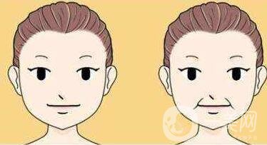 冰電波拉皮除皺*果如何？有哪些優(yōu)點(diǎn)？