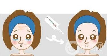 玻尿酸保持時間是多久？如何延長保持時間？