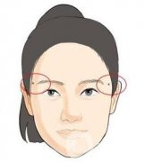 點痣后注意事項一定要遵守，否則會留疤！