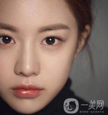 如何讓鼻梁變高？可以注射玻尿酸嗎？