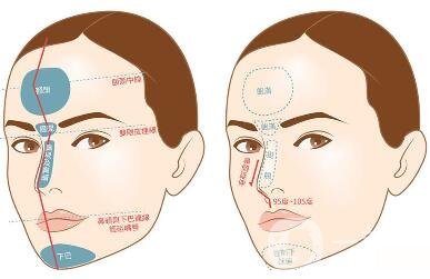 如何讓鼻梁變高？可以注射玻尿酸嗎？