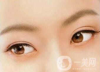 三點定位雙眼皮手術后應該注意些什么？