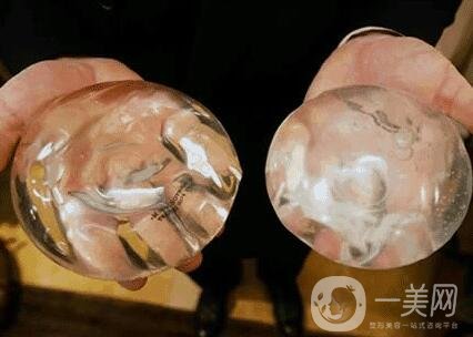 胸部整形術(shù)要多少錢?大概價(jià)位說明