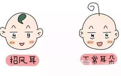 招風(fēng)耳手術(shù)多少錢(qián)?醫(yī)院收費(fèi)情況說(shuō)明