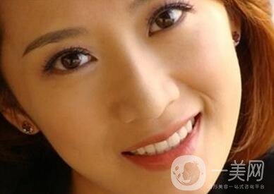 墊個(gè)鼻子要多少錢？大概價(jià)位是多少？