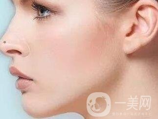 墊個(gè)鼻子要多少錢？大概價(jià)位是多少？