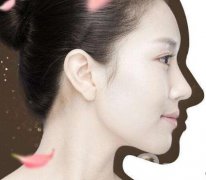 韓式立體隆鼻術(shù)的果怎么樣？