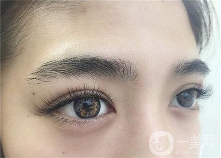 如何減少眼部皺紋？哪些方法比較*？