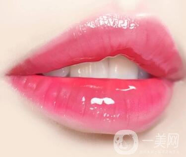 豐唇手術(shù)價(jià)格貴不貴？要多少錢？