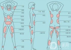 全身抽脂減肥多少錢？貴嗎？