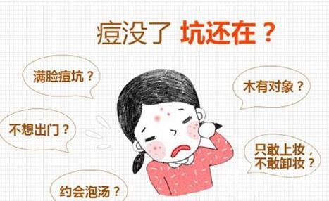 果酸換膚后注意事項(xiàng)有哪些?