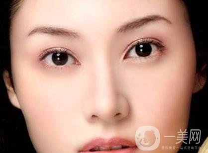吸雕雙眼皮手術(shù)是什么？是埋線嗎？