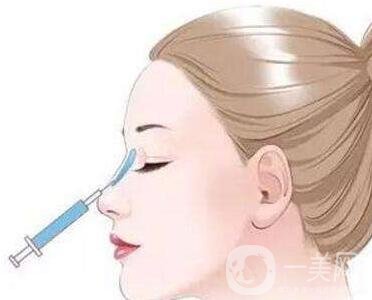 瑞蘭玻尿酸注射除皺*果怎么樣？